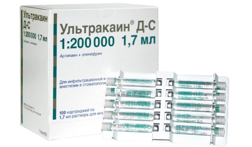 Ультракаин Д-С Р-р для инъекций 40 мг/мл + 0,005 мг/мл картридж 1,7 мл х №100